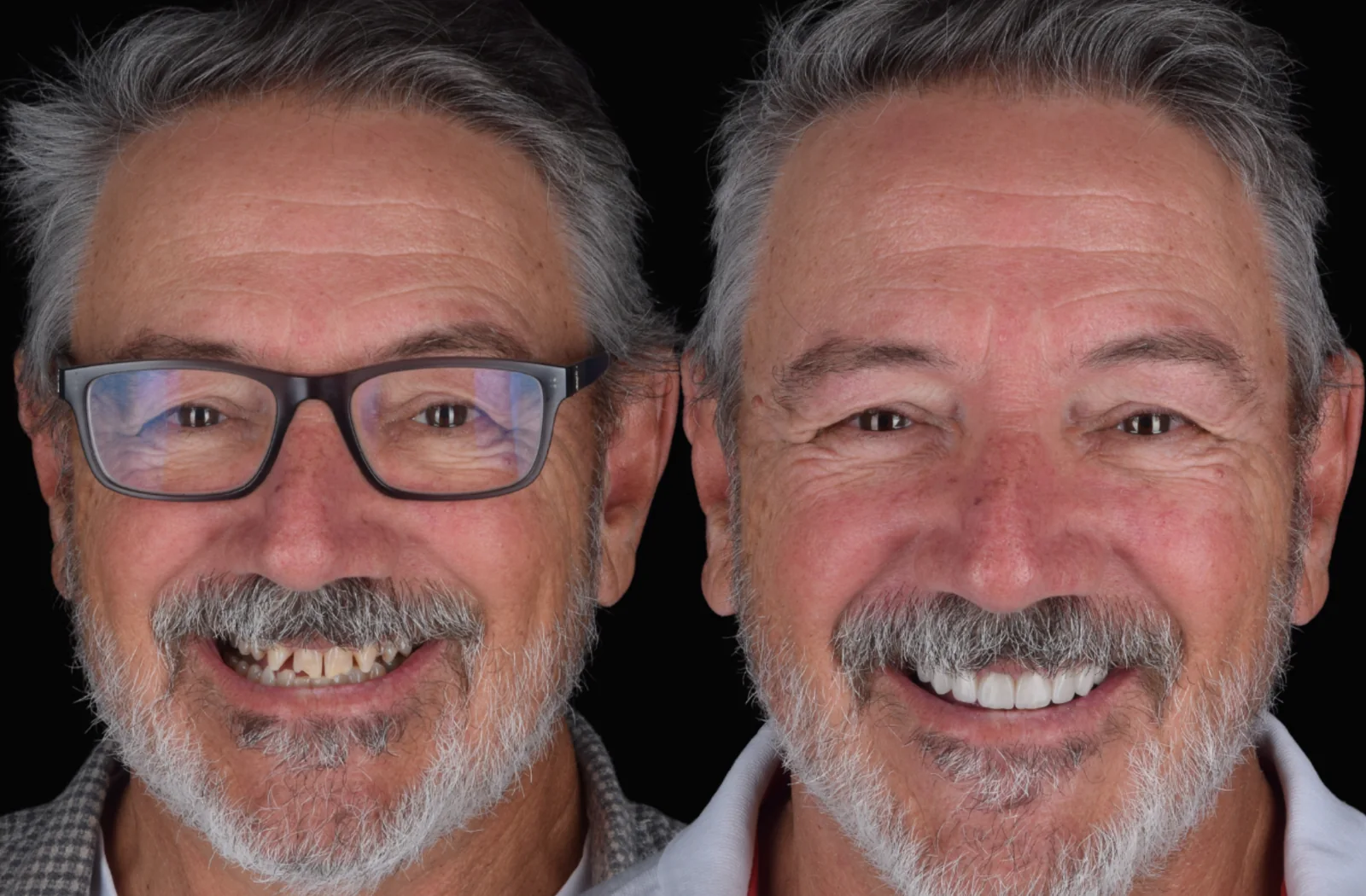 Before treatment