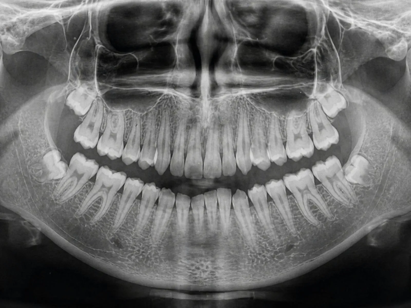 Panoramic X-ray